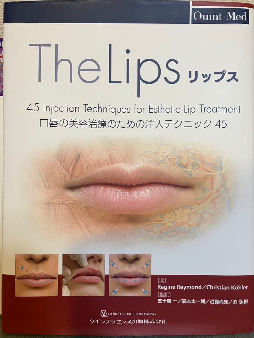 リップス 口唇の美容治療のための注入テクニック45 （Quint-Med）
