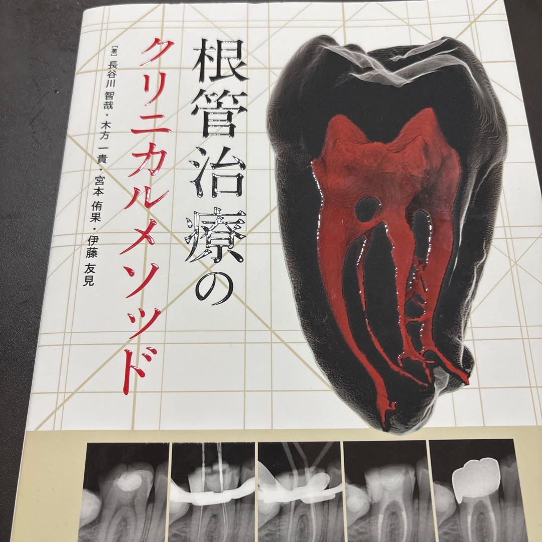 根管治療のクリニカルメソッド