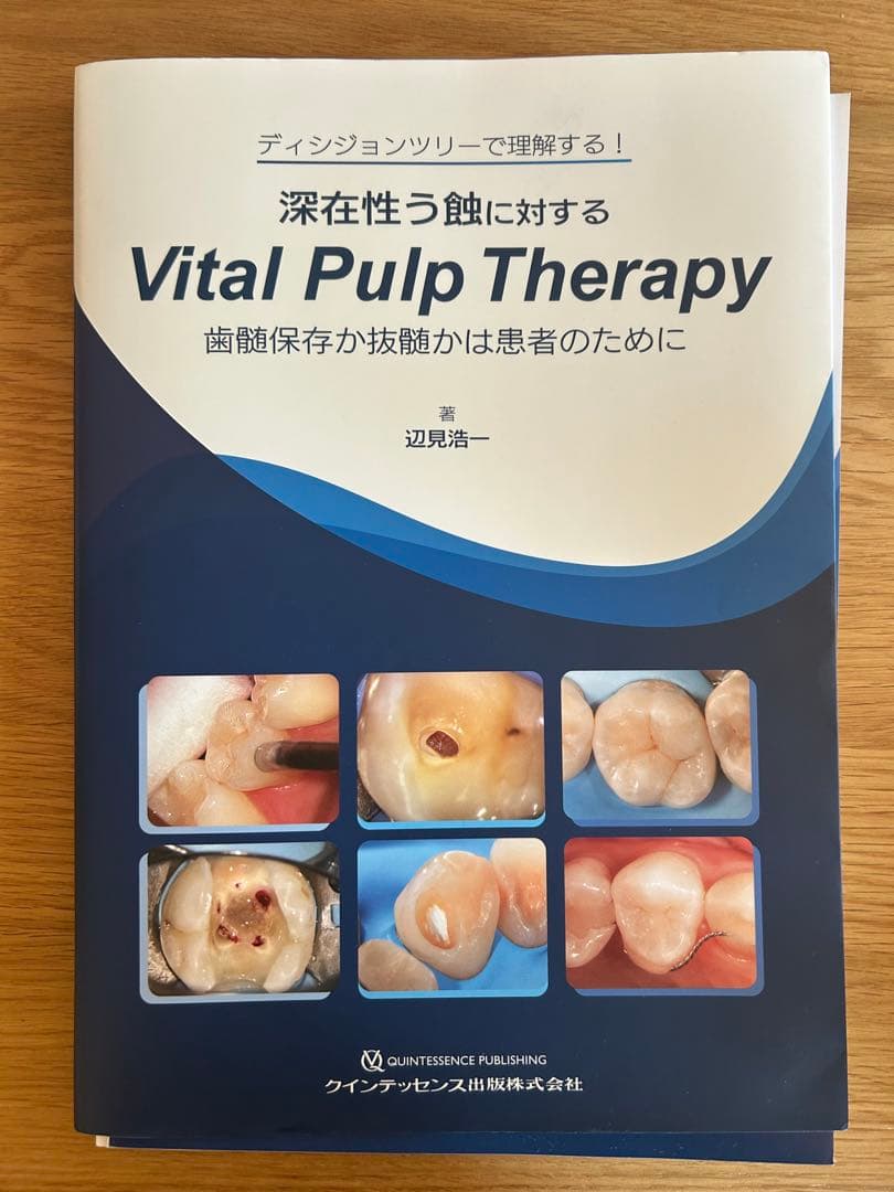 【裁断済】深在性う蝕に対するVital Pulp Therapy
