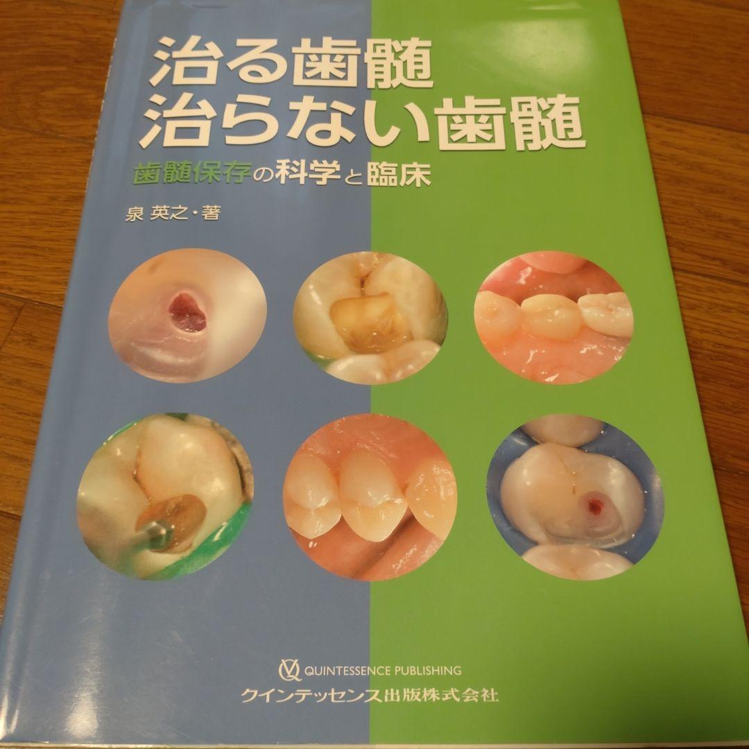 治る歯髄 治らない歯髄 歯髄保存の科学と臨床